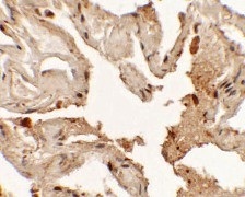 Immunohistochemistry (Formalin/PFA-fixed paraffin-embedded sections) - Anti-TTF1/Nkx2-1 antibody (AB125650), expandable thumbnail
