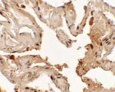 Immunohistochemistry (Formalin/PFA-fixed paraffin-embedded sections) - Anti-TTF1/Nkx2-1 antibody (AB125650)