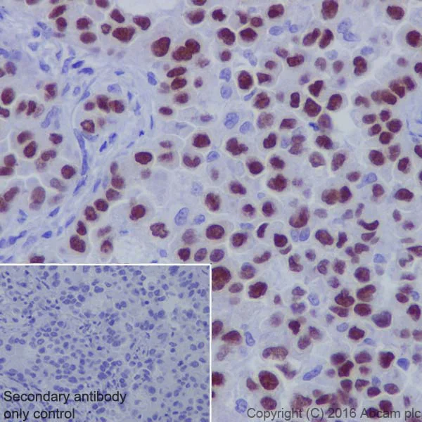 Immunohistochemistry (Formalin/PFA-fixed paraffin-embedded sections) - Anti-TTF1/Nkx2-1 antibody [EP1584Y] (AB76013)