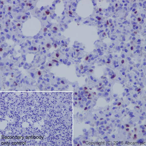 Immunohistochemistry (Formalin/PFA-fixed paraffin-embedded sections) - Anti-TTF1/Nkx2-1 antibody [EP1584Y] (AB76013)