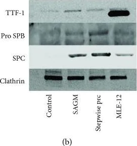 Western blot - Anti-TTF1/Nkx2-1 antibody [EP1584Y] (AB76013)