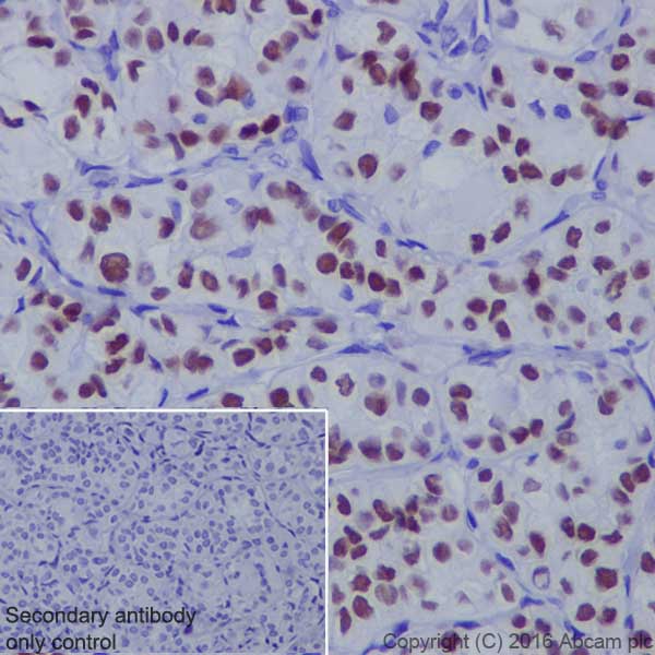 Immunohistochemistry (Formalin/PFA-fixed paraffin-embedded sections) - Anti-TTF1/Nkx2-1 antibody [EP1584Y] - BSA and Azide free (AB216648), expandable thumbnail