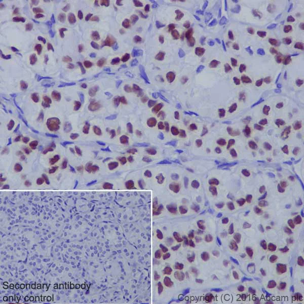 Immunohistochemistry (Formalin/PFA-fixed paraffin-embedded sections) - Anti-TTF1/Nkx2-1 antibody [EP1584Y] - BSA and Azide free (AB216648)