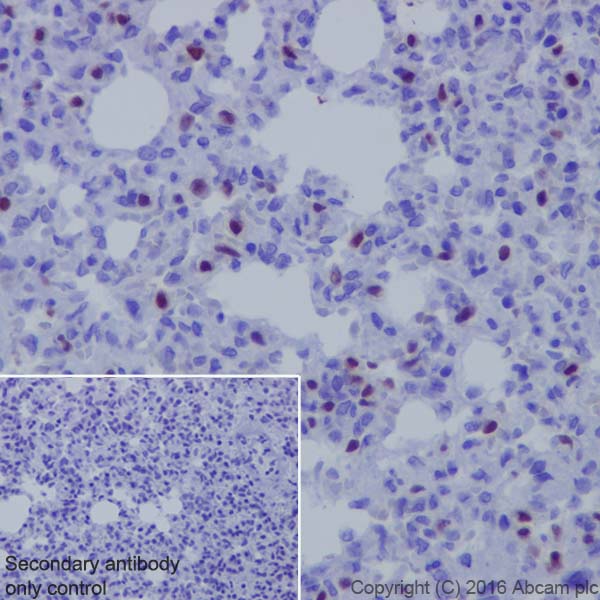 Immunohistochemistry (Formalin/PFA-fixed paraffin-embedded sections) - Anti-TTF1/Nkx2-1 antibody [EP1584Y] - BSA and Azide free (AB216648), expandable thumbnail