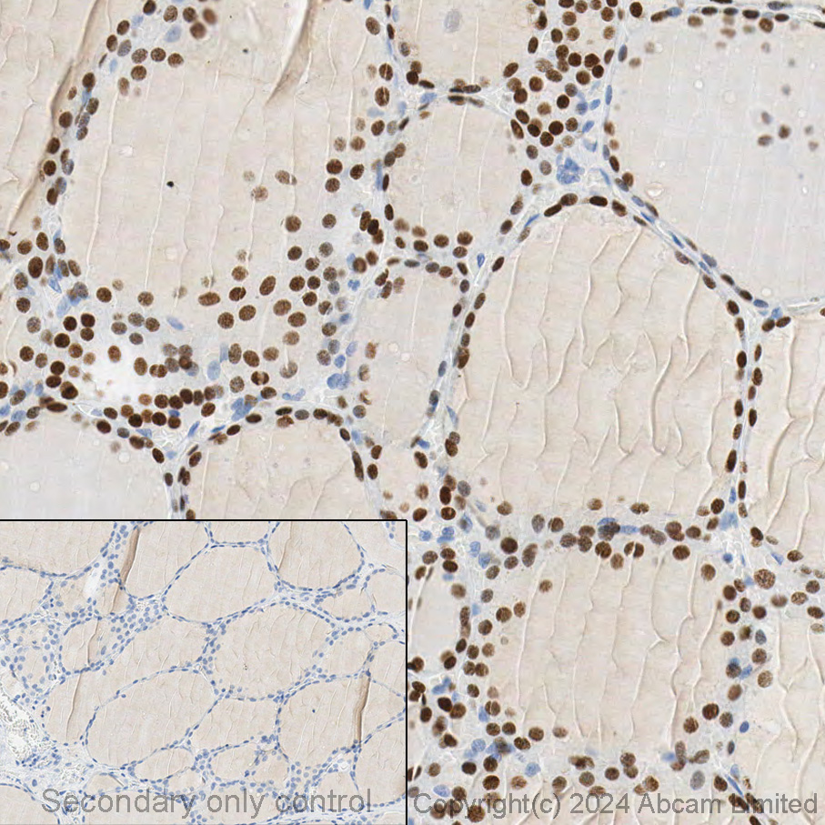 Immunohistochemistry - Anti-TTF1/Nkx2-1 antibody [EP1584Y] - BSA and Azide free (AB216648), expandable thumbnail
