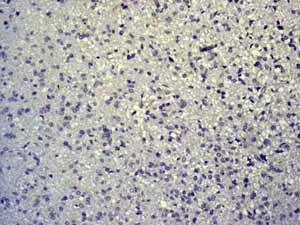 Anti-TTF1/Nkx2-1 antibody [EPR5955(2)] (ab133737) | Abcam