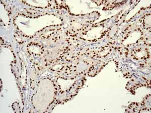 Immunohistochemistry (Formalin/PFA-fixed paraffin-embedded sections) - Anti-TTF1/Nkx2-1 antibody [EPR5955(2)] (AB133737)
