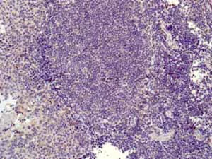 Immunohistochemistry (Formalin/PFA-fixed paraffin-embedded sections) - Anti-TTF1/Nkx2-1 antibody [EPR5955(2)] - BSA and Azide free (AB227574)