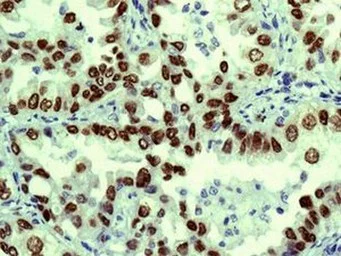 Immunohistochemistry (Formalin/PFA-fixed paraffin-embedded sections) - Anti-TTF1/Nkx2-1 antibody [EPR5955(2)] - BSA and Azide free (AB227574)