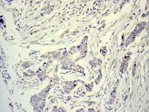 Immunohistochemistry (Formalin/PFA-fixed paraffin-embedded sections) - Anti-TTF1/Nkx2-1 antibody [EPR5955(2)] - BSA and Azide free (AB227574)