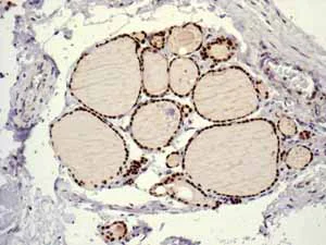 Immunohistochemistry (Formalin/PFA-fixed paraffin-embedded sections) - Anti-TTF1/Nkx2-1 antibody [EPR5955(2)] - BSA and Azide free (AB227574)