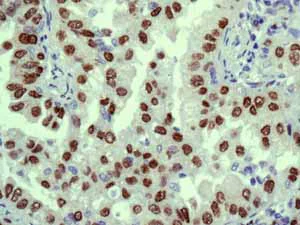 Immunohistochemistry (Formalin/PFA-fixed paraffin-embedded sections) - Anti-TTF1/Nkx2-1 antibody [EPR5955(2)] - BSA and Azide free (AB227574)