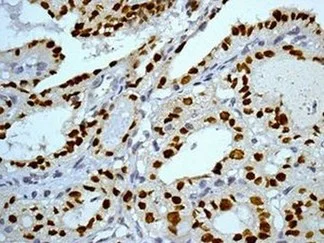 Immunohistochemistry (Formalin/PFA-fixed paraffin-embedded sections) - Anti-TTF1/Nkx2-1 antibody [EPR5955(2)] - BSA and Azide free (AB227574)
