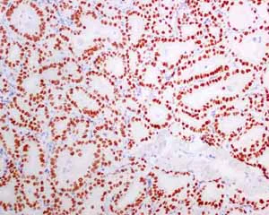 Immunohistochemistry (Formalin/PFA-fixed paraffin-embedded sections) - Anti-TTF1/Nkx2-1 antibody [EPR8190-138] (AB137061)