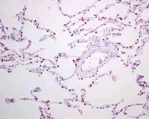 Immunohistochemistry (Formalin/PFA-fixed paraffin-embedded sections) - Anti-TTF1/Nkx2-1 antibody [EPR8190-138] (AB137061)