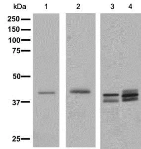 Western blot - Anti-TTF1/Nkx2-1 antibody [EPR8190-138] (AB137061)