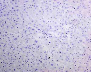 Immunohistochemistry (Formalin/PFA-fixed paraffin-embedded sections) - Anti-TTF1/Nkx2-1 antibody [EPR8190-138] - BSA and Azide free (AB227576), expandable thumbnail