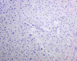 Immunohistochemistry (Formalin/PFA-fixed paraffin-embedded sections) - Anti-TTF1/Nkx2-1 antibody [EPR8190-138] - BSA and Azide free (AB227576)
