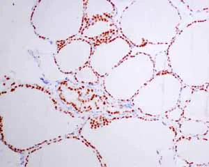 Immunohistochemistry (Formalin/PFA-fixed paraffin-embedded sections) - Anti-TTF1/Nkx2-1 antibody [EPR8190-138] - BSA and Azide free (AB227576)