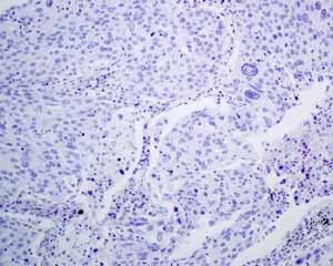 Immunohistochemistry (Formalin/PFA-fixed paraffin-embedded sections) - Anti-TTF1/Nkx2-1 antibody [EPR8190-138] - BSA and Azide free (AB227576), expandable thumbnail
