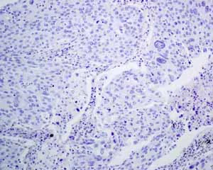 Immunohistochemistry (Formalin/PFA-fixed paraffin-embedded sections) - Anti-TTF1/Nkx2-1 antibody [EPR8190-138] - BSA and Azide free (AB227576)