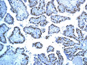 Immunohistochemistry (Formalin/PFA-fixed paraffin-embedded sections) - Anti-TTF1/Nkx2-1 antibody [EPR8190-138] - BSA and Azide free (ab227576), expandable thumbnail