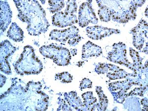 Immunohistochemistry (Formalin/PFA-fixed paraffin-embedded sections) - Anti-TTF1/Nkx2-1 antibody [EPR8190-138] - BSA and Azide free (AB227576)