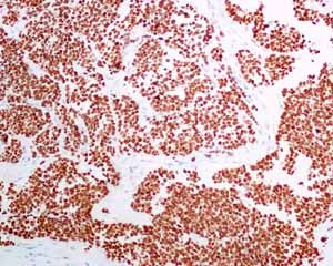 Immunohistochemistry (Formalin/PFA-fixed paraffin-embedded sections) - Anti-TTF1/Nkx2-1 antibody [EPR8190-138] - BSA and Azide free (AB227576), expandable thumbnail