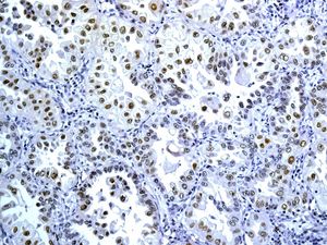 Immunohistochemistry (Formalin/PFA-fixed paraffin-embedded sections) - Anti-TTF1/Nkx2-1 antibody [EPR8190-138] - BSA and Azide free (AB227576), expandable thumbnail