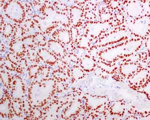 Immunohistochemistry (Formalin/PFA-fixed paraffin-embedded sections) - Anti-TTF1/Nkx2-1 antibody [EPR8190-138] - BSA and Azide free (AB227576), expandable thumbnail