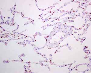 Immunohistochemistry (Formalin/PFA-fixed paraffin-embedded sections) - Anti-TTF1/Nkx2-1 antibody [EPR8190-138] - BSA and Azide free (ab227576), expandable thumbnail