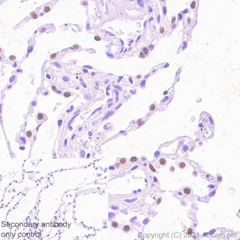 Immunohistochemistry (Formalin/PFA-fixed paraffin-embedded sections) - Anti-TTF1/Nkx2-1 antibody [EPR8190-6] (AB133638)