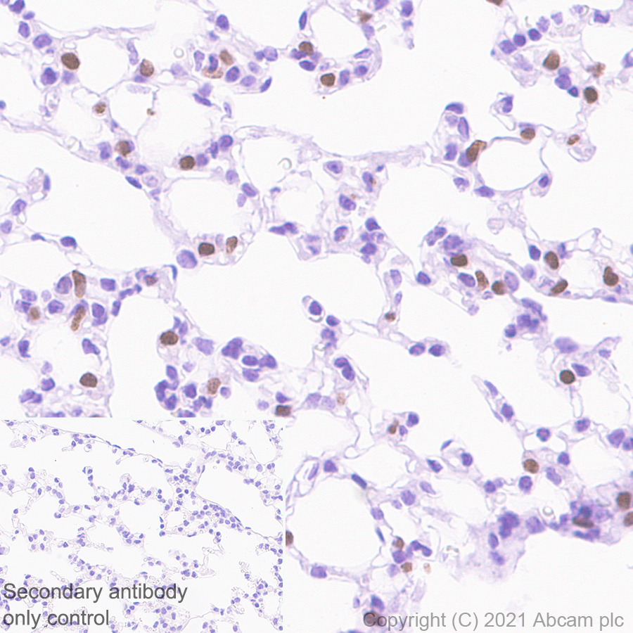 Immunohistochemistry (Formalin/PFA-fixed paraffin-embedded sections) - Anti-TTF1/Nkx2-1 antibody [EPR8190-6] (AB133638), expandable thumbnail