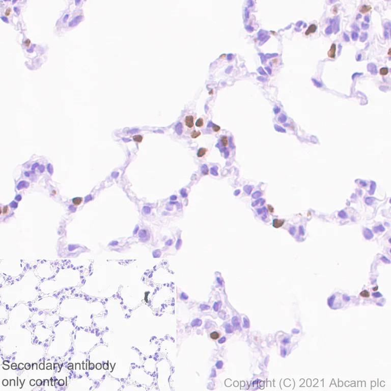 Immunohistochemistry (Formalin/PFA-fixed paraffin-embedded sections) - Anti-TTF1/Nkx2-1 antibody [EPR8190-6] - BSA and Azide free (AB227575)