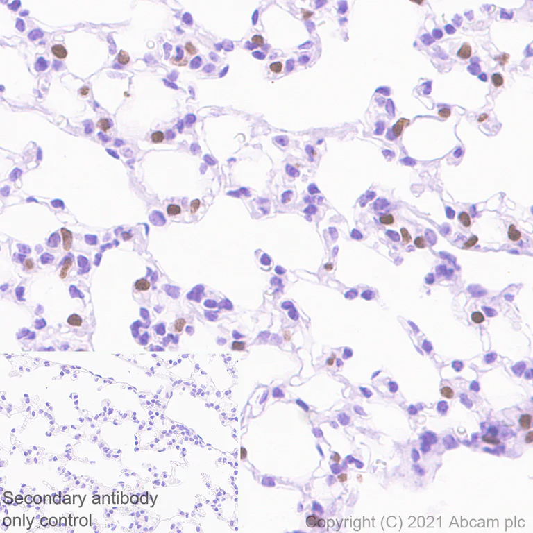 Immunohistochemistry (Formalin/PFA-fixed paraffin-embedded sections) - Anti-TTF1/Nkx2-1 antibody [EPR8190-6] - BSA and Azide free (AB227575)