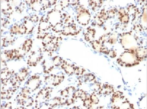 Immunohistochemistry (Formalin/PFA-fixed paraffin-embedded sections) - Anti-TTF1/Nkx2-1 antibody [NX2.1/690] (AB220211)