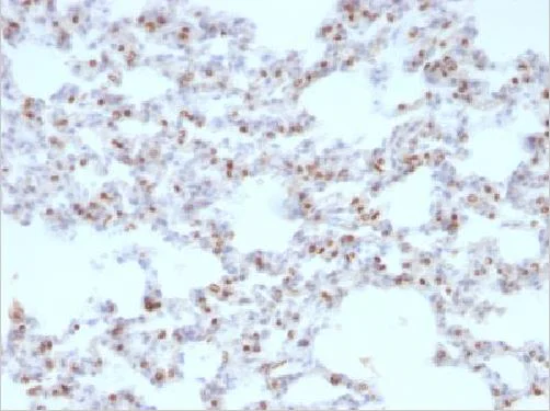 Immunohistochemistry (Formalin/PFA-fixed paraffin-embedded sections) - Anti-TTF1/Nkx2-1 antibody [NX2.1/690] (AB220211)