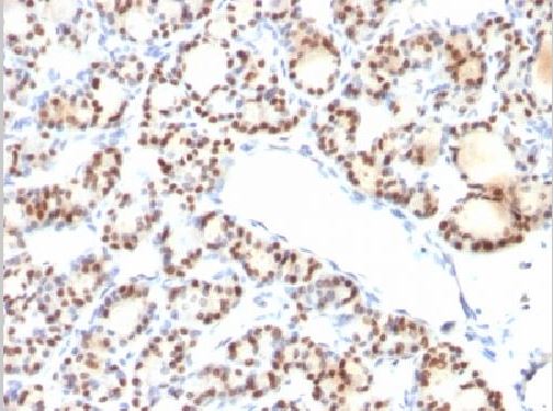 Immunohistochemistry (Formalin/PFA-fixed paraffin-embedded sections) - Anti-TTF1/Nkx2-1 antibody [NX2.1/690] - BSA and Azide free (AB212888), expandable thumbnail