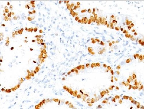 Immunohistochemistry (Formalin/PFA-fixed paraffin-embedded sections) - Anti-TTF1/Nkx2-1 antibody [NX2.1/690] - BSA and Azide free (AB212888), expandable thumbnail