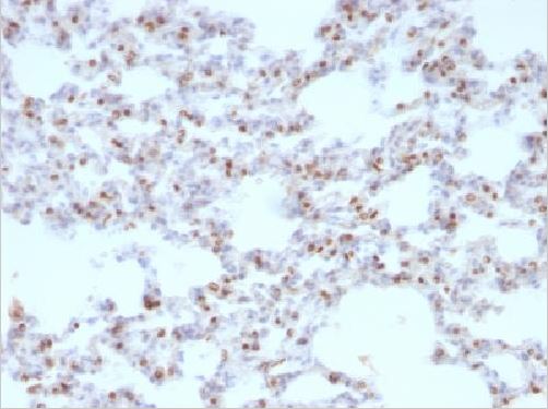 Immunohistochemistry (Formalin/PFA-fixed paraffin-embedded sections) - Anti-TTF1/Nkx2-1 antibody [NX2.1/690] - BSA and Azide free (AB212888), expandable thumbnail