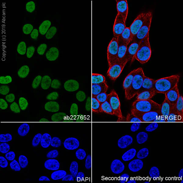 Immunocytochemistry/ Immunofluorescence - Anti-TTF1/Nkx2-1 antibody [SP141] - BSA and Azide free (AB242428)