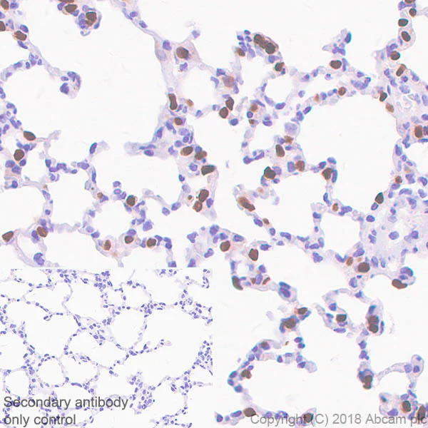 Immunohistochemistry (Formalin/PFA-fixed paraffin-embedded sections) - Anti-TTF1/Nkx2-1 antibody [SP141] - BSA and Azide free (AB242428)