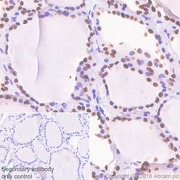 Immunohistochemistry (Formalin/PFA-fixed paraffin-embedded sections) - Anti-TTF1/Nkx2-1 antibody [SP141] - BSA and Azide free (AB242428)