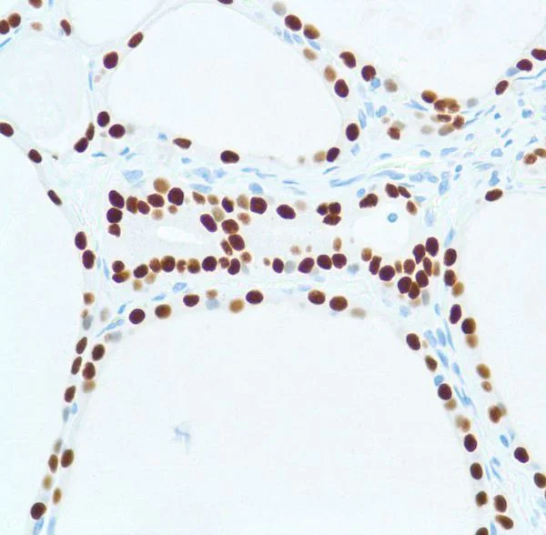 Immunohistochemistry (Formalin/PFA-fixed paraffin-embedded sections) - Anti-TTF1/Nkx2-1 antibody [SP141] - BSA and Azide free (AB242428)