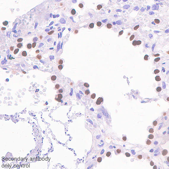 Immunohistochemistry (Formalin/PFA-fixed paraffin-embedded sections) - Anti-TTF1/Nkx2-1 antibody [SP141] - BSA and Azide free (AB242428)