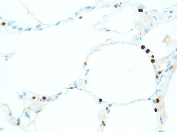 Immunohistochemistry (Formalin/PFA-fixed paraffin-embedded sections) - Anti-TTF1/Nkx2-1 antibody [SP141] - BSA and Azide free (AB242428)