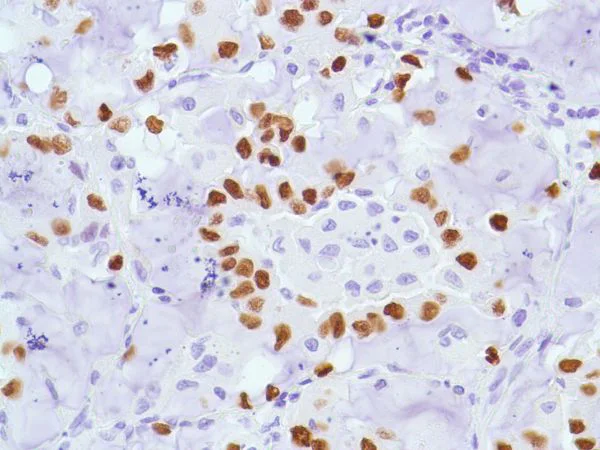 Immunohistochemistry (Formalin/PFA-fixed paraffin-embedded sections) - Anti-TTF1/Nkx2-1 antibody [SP141] - BSA and Azide free (AB242428)