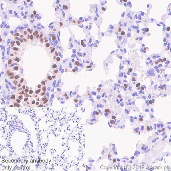 Immunohistochemistry (Formalin/PFA-fixed paraffin-embedded sections) - Anti-TTF1/Nkx2-1 antibody [SP141] - BSA and Azide free (AB242428)