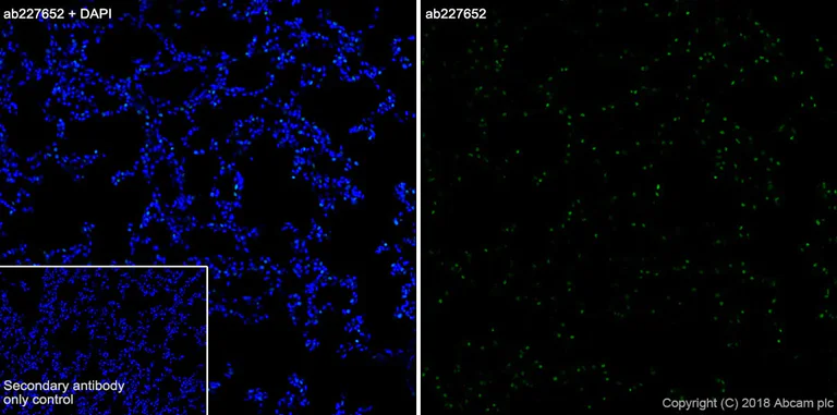 Immunohistochemistry (Frozen sections) - Anti-TTF1/Nkx2-1 antibody [SP141] - BSA and Azide free (AB242428)