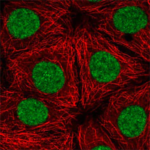 Immunocytochemistry/ Immunofluorescence - Anti-TTF1/Transcription termination factor 1 antibody (AB204411)